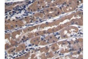 Detection of PECAM1 in Human Stomach Tissue using Polyclonal Antibody to Platelet/Endothelial Cell Adhesion Molecule (PECAM1) (CD31 Antikörper  (AA 199-287))