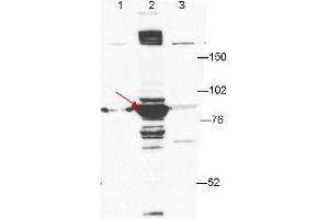Anti-ESRP-1 by western blot shows detection of ESRP-1 in transfected 293T cell extracts (lane 2, arrowhead). (ESRP1 Antikörper)