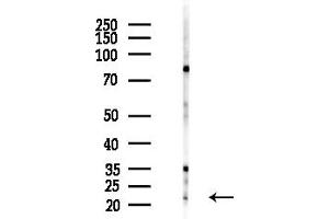 Western blot analysis of lysates from HepG2 cells(LPS,4h treatment), using DIR Antibody at 1/1000 dilution.