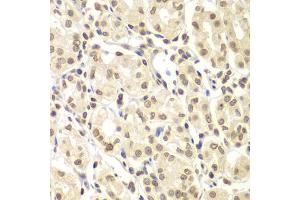 Immunohistochemistry of paraffin-embedded human gastric using ULK4 antibody (ABIN5975557) at dilution of 1/100 (40x lens). (ULK4 Antikörper)