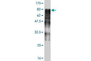 Western Blot detection against Immunogen (73. (ZSCAN20 Antikörper  (AA 1-433))