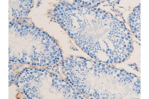 ABIN6267068 at 1/100 staining mouse testis tissue sections by IHC-P. (Smooth Muscle Actin Antikörper  (N-Term))