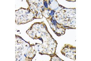 Immunohistochemistry of paraffin-embedded human placenta using TLR3 Rabbit pAb (ABIN6130066, ABIN6149219, ABIN6149220 and ABIN6215465) at dilution of 1:100 (40x lens).