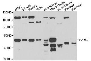 Western blot analysis of extracts of various cell lines, using P2RX2 antibody. (P2RX2 Antikörper  (AA 60-320))