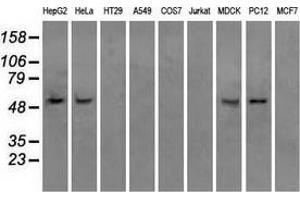 Western blot analysis of extracts (35 µg) from 9 different cell lines by using anti-ATP5B monoclonal antibody. (ATP5B Antikörper)