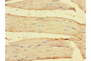 Immunohistochemistry of paraffin-embedded human skeletal muscle tissue using ABIN7162143 at dilution of 1:100 (OLFML1 Antikörper  (AA 201-402))