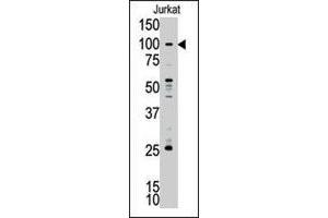 Western blot analysis of MLLT10 polyclonal antibody  in Jurkat cell lysate.