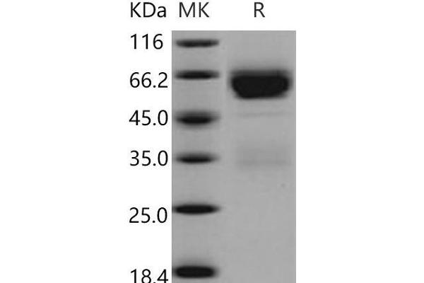 SERPINA11 Protein (His tag)