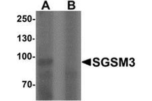 Western blot analysis of SGSM3 in 293 cell lysate with SGSM3 Antibody  at 1 ug/mL in (A) the absence and (B) the presence of blocking peptide. (SGSM3 Antikörper  (N-Term))