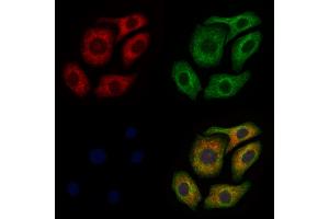 ABIN6260299 and ABIN6277920 staining Hela cells by IF/ICC. (BSP Antikörper  (Internal Region))