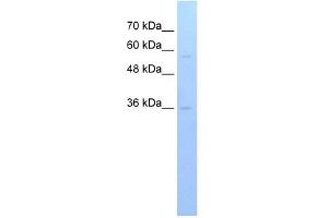 RFPL3 antibody used at 1 ug/ml to detect target protein. (RFPL3 Antikörper  (C-Term))