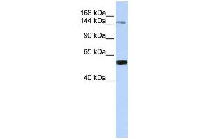 WB Suggested Anti-EDC4 Antibody Titration: 0. (EDC4 Antikörper  (N-Term))