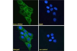 ABIN570879 Immunofluorescence analysis of paraformaldehyde fixed A431 cells, permeabilized with 0. (Ataxin 2 Antikörper  (Internal Region))