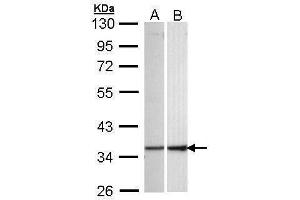 WB Image Sample (30 ug of whole cell lysate) A: 293T B: Hep G2 , 10% SDS PAGE antibody diluted at 1:1000 (ECHS1 Antikörper)