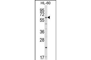 Western blot analysis of CYP51A1 Antibody in HL-60 cell line lysates (35ug/lane) (CYP51A1 Antikörper  (C-Term))
