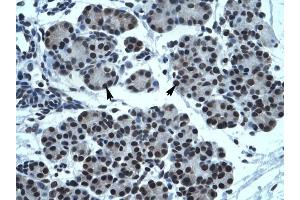 TPTE antibody was used for immunohistochemistry at a concentration of 4-8 ug/ml to stain Epithelial cells of pancreatic acinus (arrows) in Human Pancreas.