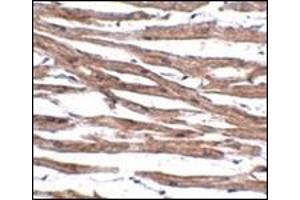 Immunohistochemistry of MAK10 in human heart tissue with this product at 5 μg/ml.