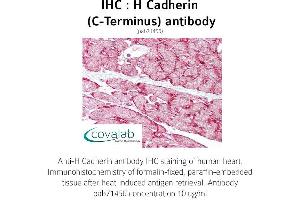 Image no. 1 for anti-Cadherin 13 (CDH13) (C-Term) antibody (ABIN5693589) (Cadherin 13 Antikörper  (C-Term))