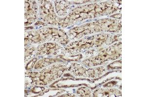 Immunohistochemistry of paraffin-embedded rat liver using [KO Validated] Heme Oxygenase 1 (HO-1/HMOX1) Rabbit pAb (ABIN6131781, ABIN6141881, ABIN6141883 and ABIN6215065) at dilution of 1:50 (40x lens). (HMOX1 Antikörper  (AA 1-288))