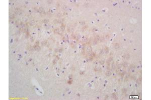 Formalin-fixed and paraffin embedded rat brain labeled with Rabbit Anti gamma Synuclein Polyclonal Antibody, Unconjugated (ABIN671001) at 1:200 followed by conjugation to the secondary antibody and DAB staining (SNCG Antikörper  (AA 2-123))