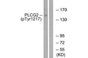 Western blot analysis of extracts from Jurkat cells treated with UV 15', using PLCG2 (Phospho-Tyr1217) Antibody. (Phospholipase C gamma 2 Antikörper  (pTyr1217))