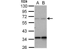 Western Blotting (WB) image for anti-Protein Phosphatase 4, Regulatory Subunit 2 (PPP4R2) (AA 1-360) antibody (ABIN1500387) (PPP4R2 Antikörper  (AA 1-360))