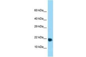 Image no. 1 for anti-Ribosomal Protein L32 (RPL32) (AA 61-110) antibody (ABIN6748313) (RPL32 Antikörper  (AA 61-110))