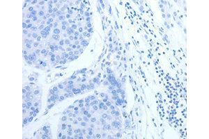 Immunohistochemistry (IHC) image for anti-Complement Factor H-Related 1 (CFHR1) antibody (ABIN1871806) (CFHR1 Antikörper)