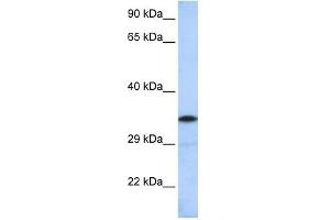 KCTD4 antibody used at 1 ug/ml to detect target protein.