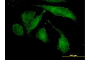 Immunofluorescence of monoclonal antibody to ROCK2 on HeLa cell.