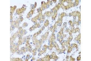 Immunohistochemistry of paraffin-embedded Human liver using MOK Polyclonal Antibody at dilution of 1:100 (40x lens).