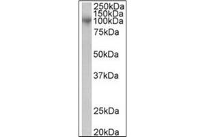 Image no. 1 for anti-ADAM Metallopeptidase Domain 8 (ADAM8) (C-Term) antibody (ABIN374195) (ADAM8 Antikörper  (C-Term))