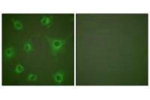 Immunofluorescence analysis of COS7 cells, using Collagen II antibody. (COL2A1 Antikörper)