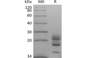 Western Blotting (WB) image for Interleukin 17A (IL17A) (Active) protein (His tag) (ABIN7321033) (Interleukin 17a Protein (His tag))
