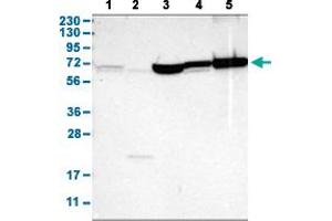 Western Blot analysis with SHOC2 polyclonal antibody . (SHoc2/Sur8 Antikörper  (AA 455-562))