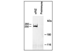 Image no. 1 for anti-PR Domain Containing 2, with ZNF Domain (PRDM2) (AA 245-573) antibody (ABIN356710) (PRDM2 Antikörper  (AA 245-573))