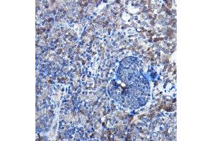 Immunohistochemistry of paraffin-embedded rat lymph node using Bax Rabbit mAb  at dilution of 1:25,1:50 (40x lens). (BAX Antikörper)