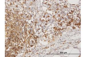 Immunostaining (ISt) image for anti-Membrane-Spanning 4-Domains, Subfamily A, Member 1 (MS4A1) (AA 1-297) antibody (ABIN514162)
