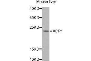 Western blot analysis of extracts of mouse liver, using ACP1 Antibody. (ACP1 Antikörper)