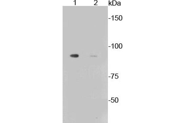 Glycogen Synthase 1 Antikörper  (pSer641)