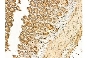 ABIN6255991 and ABIN6267509 at 1/100 staining Rat colon tissue by IHC-P.