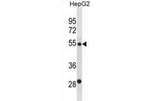 Western Blotting (WB) image for anti-ST6 beta-Galactosamide alpha-2,6-Sialyltranferase 2 (ST6GAL2) antibody (ABIN3000959)