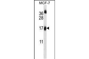 Western blot analysis in MCF-7 cell line lysates (35ug/lane). (UBE2W Antikörper  (C-Term))