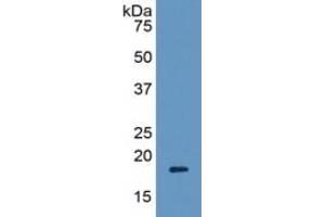 WB of Protein Standard: different control antibodies against Highly purified E.