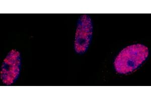Immunofluorescence (IF) image for anti-Structural Maintenance of Chromosomes 1A (SMC1A) (pSer966) antibody (ABIN7455211)