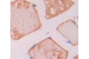 IHC-P analysis of Rat Tissue, with DAB staining. (Thrombospondin 1 Antikörper  (AA 511-670))