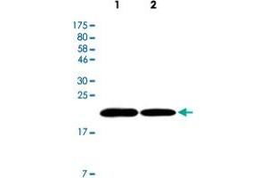 Western Blot analysis of Lane 1: U87 mg cell lysate and Lane 2: HeLa cell lysate with FTH1 monoclonal antibody, clone 3F8 . (FTH1 Antikörper)