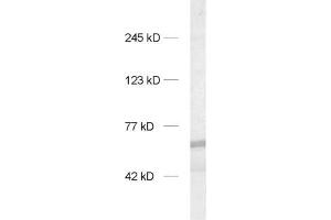 dilution: 1 : 1000, sample: rat brain homogenate (INA Antikörper)
