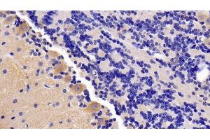 Immunohistochemistry (IHC) image for anti-Brain-Derived Neurotrophic Factor (BDNF) (AA 20-252) antibody (ABIN7430375)