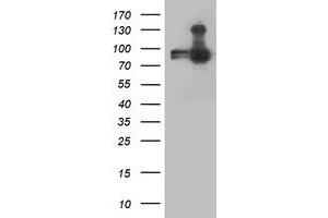 Western Blotting (WB) image for anti-Anaphase Promoting Complex Subunit 2 (ANAPC2) antibody (ABIN1496638)